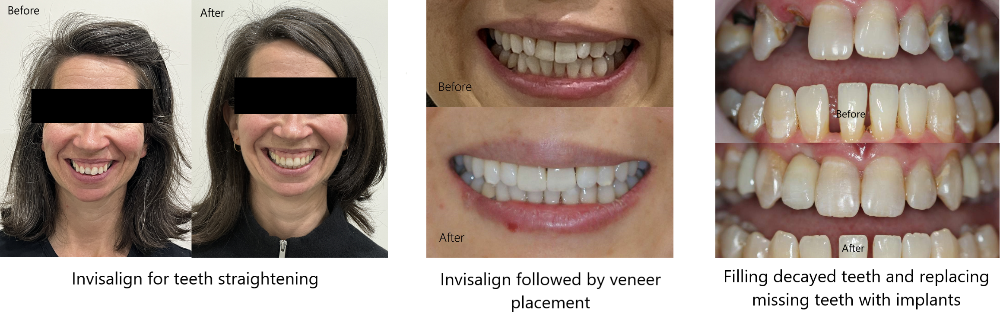 dental cases by Dr Yew